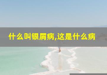 什么叫银屑病,这是什么病