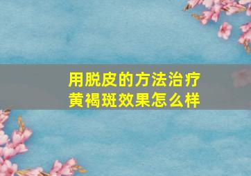 用脱皮的方法治疗黄褐斑效果怎么样