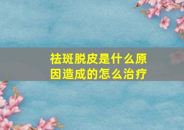 祛斑脱皮是什么原因造成的怎么治疗