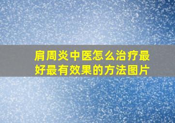 肩周炎中医怎么治疗最好最有效果的方法图片