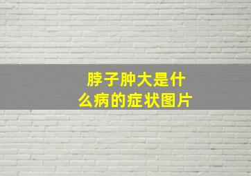 脖子肿大是什么病的症状图片