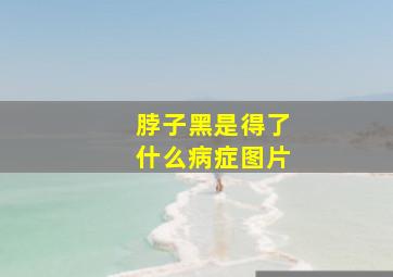 脖子黑是得了什么病症图片